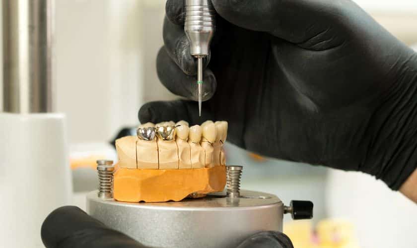 Dental crown Bowling Green, KY - Simon Dentistry