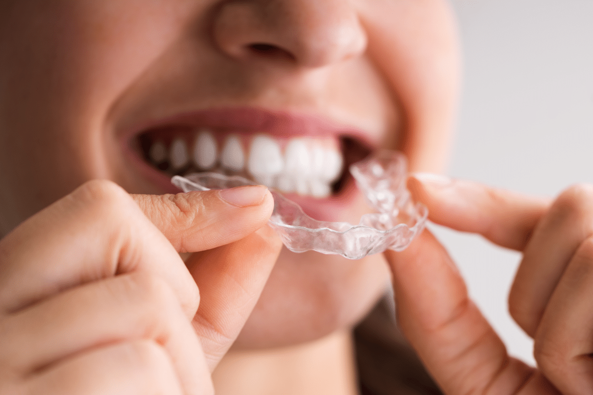 Night Guards for TMJ Relief Tips from a Dentist in Bowling Green