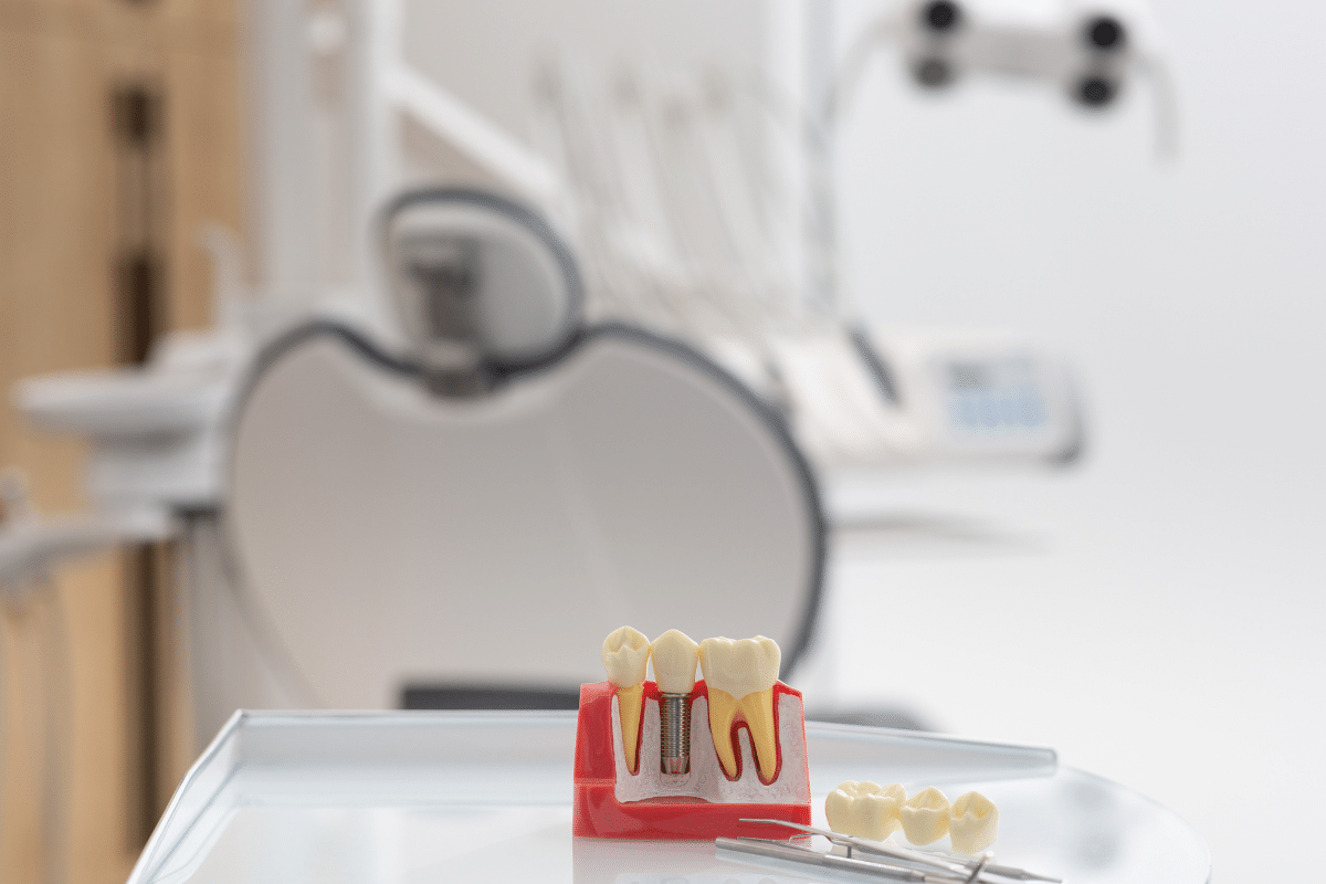 dental implants for missing teeth