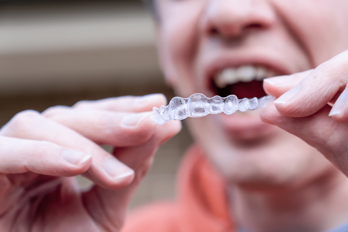 Straighten Your Smile with clear Alligner