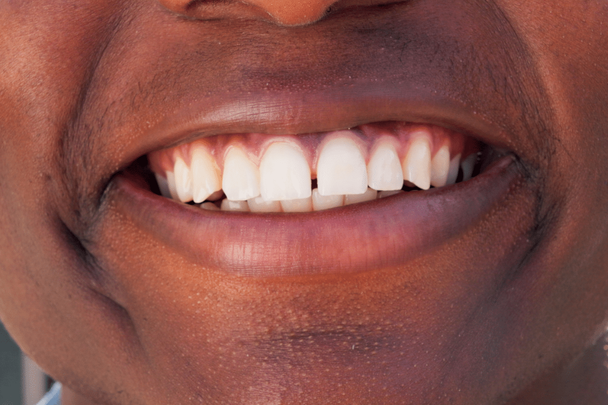 Personalized Cosmetic Dental Care
