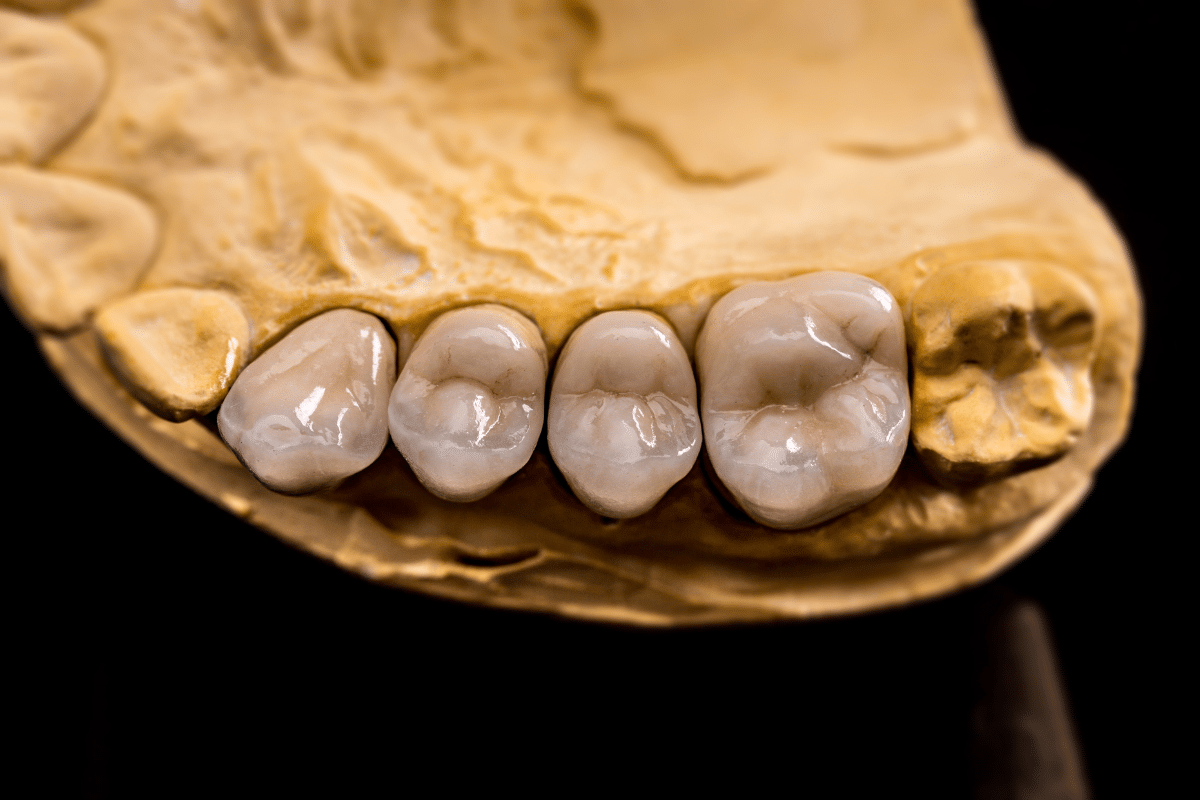 Dental Crown For Damage Teeth